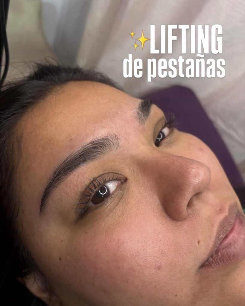 Auréa