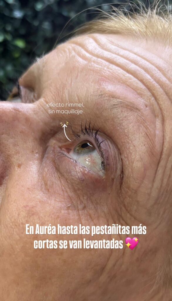Auréa